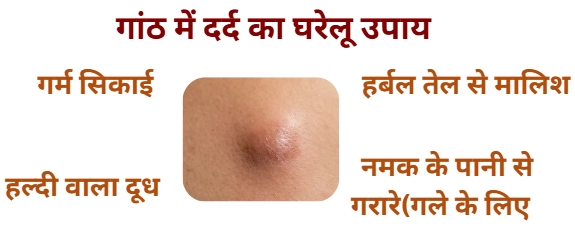 गांठ में दर्द का घरेलू उपाय