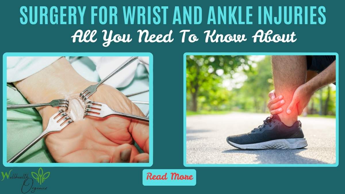 Surgery For Wrist And Ankle Injuries